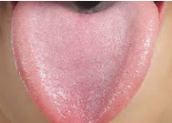 healthy tongue